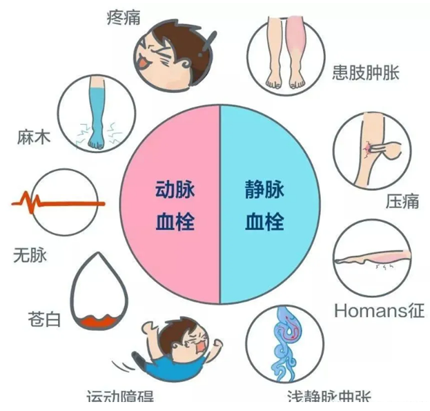 2022世界血栓日：就医有新路，血栓找介入