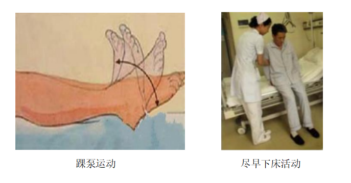 围术期患者VTE的预防，只知道抗凝可不行