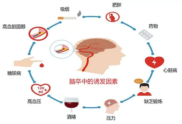脑梗与深静脉血栓：不可忽视的血管危机